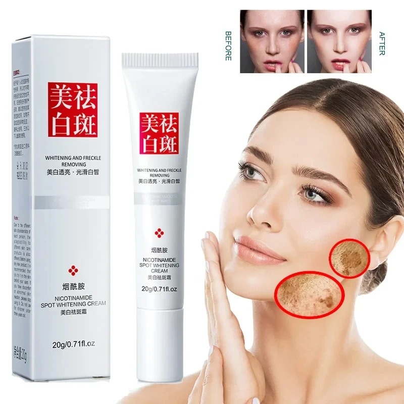 Fade and Improve Freckles Blac - Healing Wellness 评论和价格